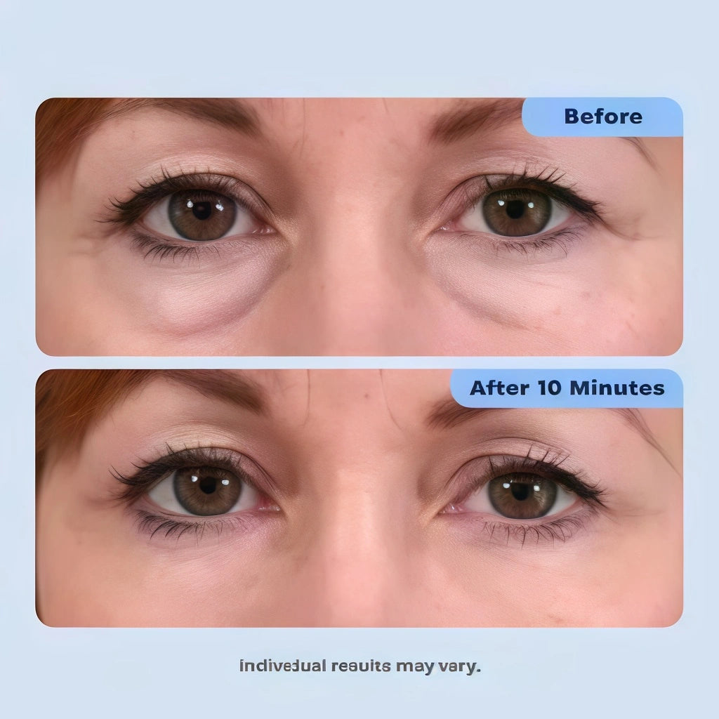 Rapid Reduction Serum – 1-Month Supply
