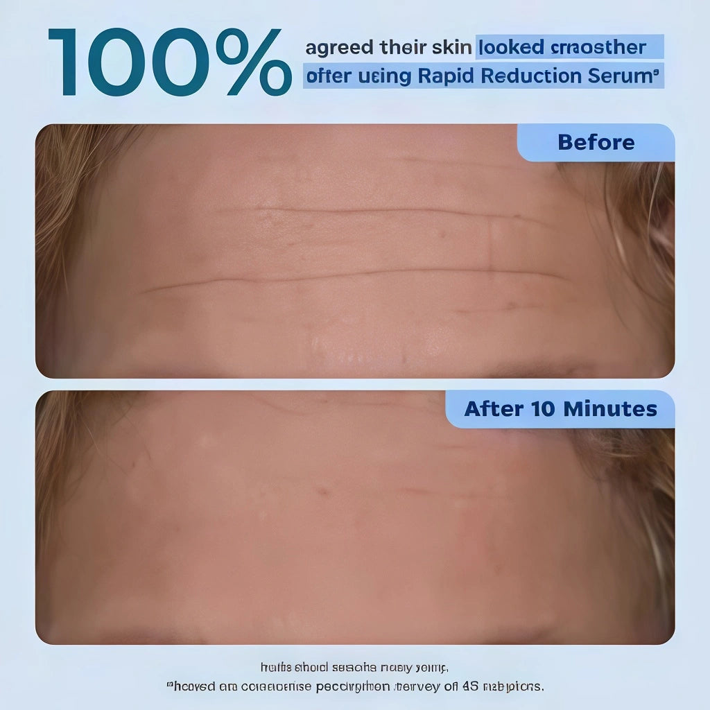 Rapid Reduction Serum – 1-Month Supply