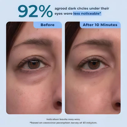 Rapid Reduction Serum – 1-Month Supply
